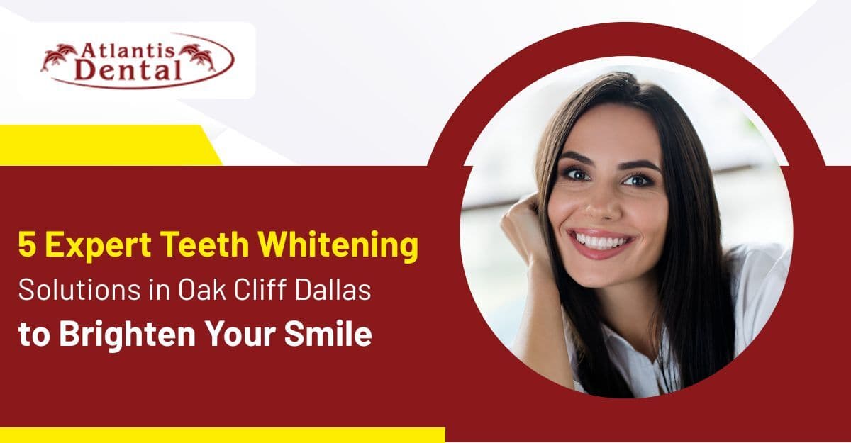 5 Expert Teeth Whitening Solutions in Oak Cliff Dallas to Brighten Your Smile