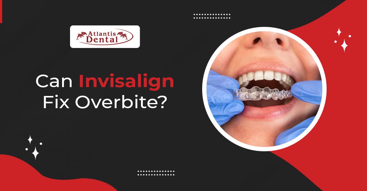 Can Invisalign Fix Overbite?