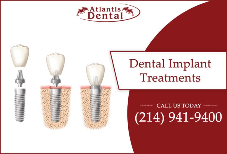 Dental implants for your perfect smile and dental health