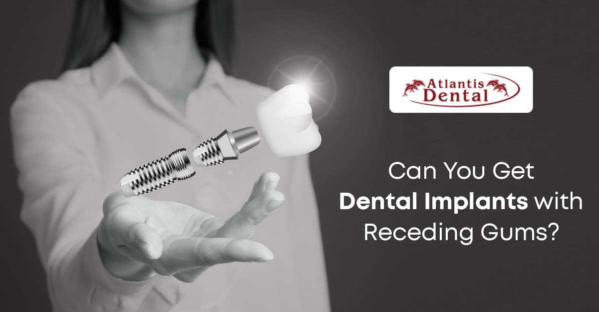 Can You Have Dental Implants with Receding Gums?