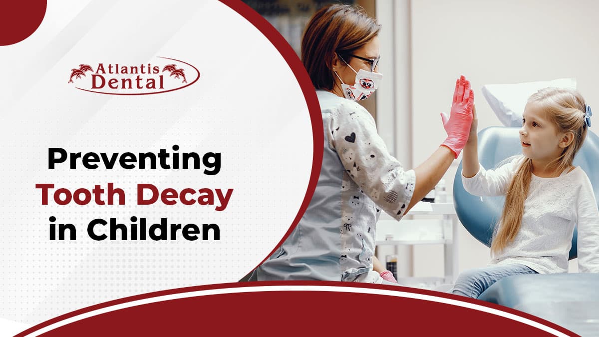 Preventing Tooth Decay in Children