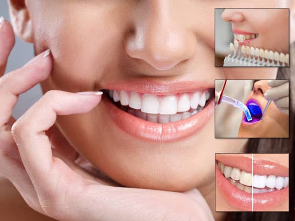 Reinvent your smile with seven cosmetic dentistry treatment