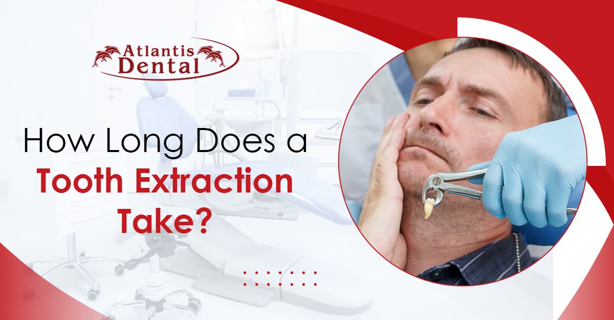 How Long Does a Tooth Extraction Take?